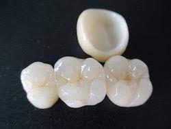 Tooth Crown